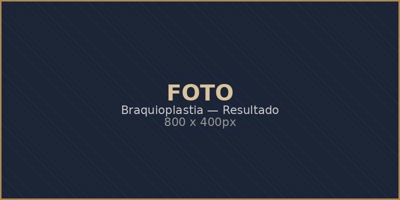 Braquioplastia — Resultado